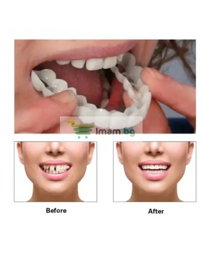 Изкуствени зъби протези WhiteSmile